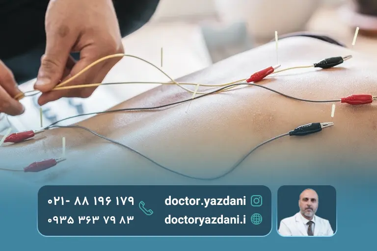 انواع طب سوزنی